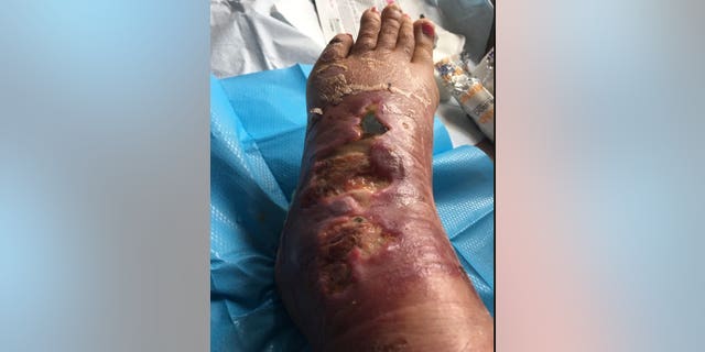 Faye Wilkes while she was in the Royal Surrey Hospital.