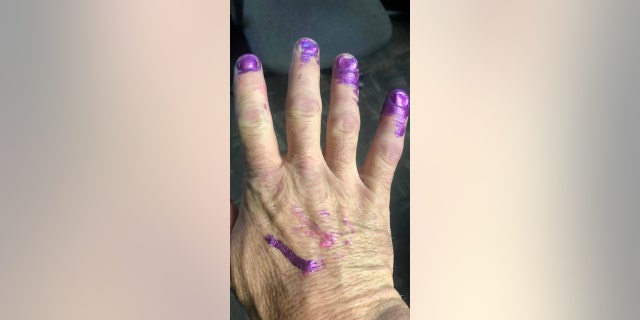 “Within minutes, the child was calmly paining their nails and had forgotten about the accident she had just experienced,” reps for the fire department later said.
