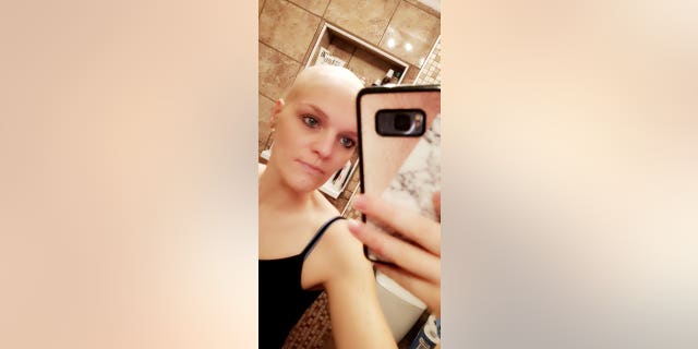 Claire Curtis after losing her hair.
