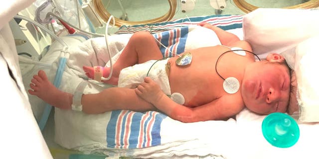 Lucas Santa Maria was diagnosed with exencephaly early into his mother's pregnancy.