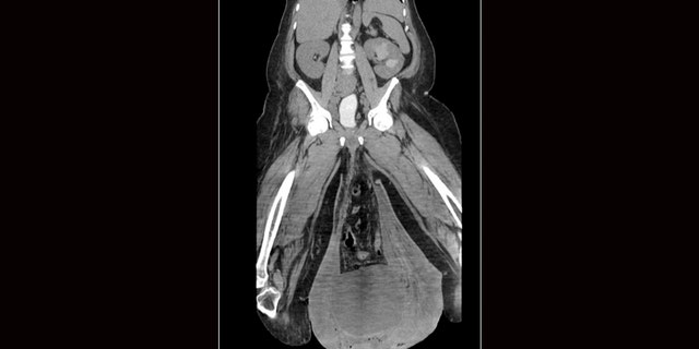 The man's CT scan.