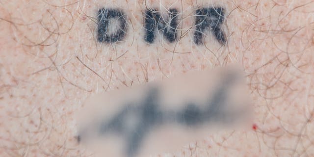 The tattoo will likely have to comply with the same standards as a living will, so it is not clear if it doctors will be able to honor it in case of an emergency.