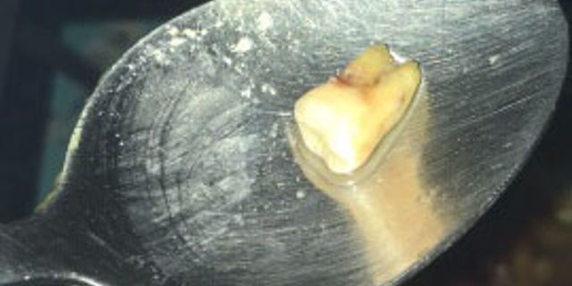 The object has been taken in for testing to determine if it is, in fact, a human tooth.