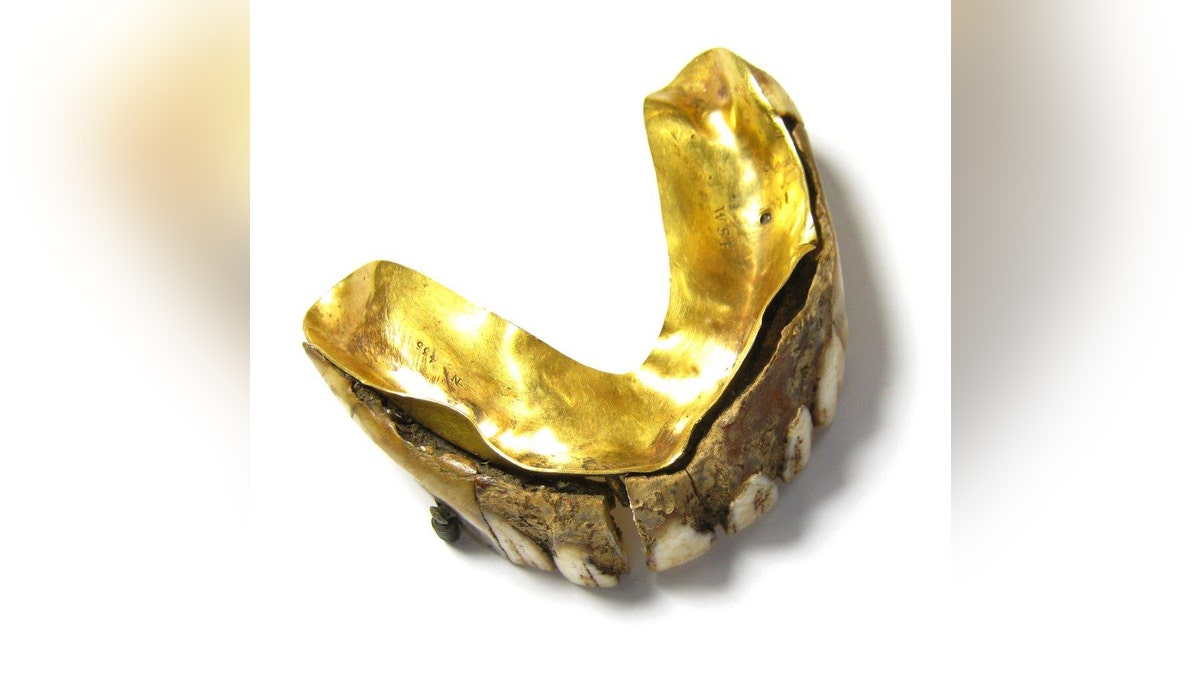 The dentures are made out of gold, and, possibly, hippo ivory. (Hansons Auctioneers and Valuers)