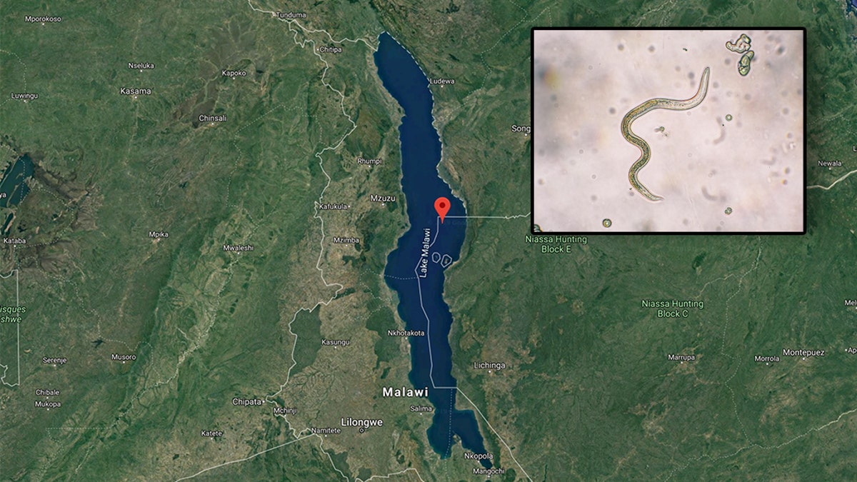 A British man nearly died after a parasite crawled up his penis and started laying eggs after he went for a swim in Lake Malawi in southeast Africa during a "holiday of a lifetime" with pals. (Photo: Google Maps/iStock)