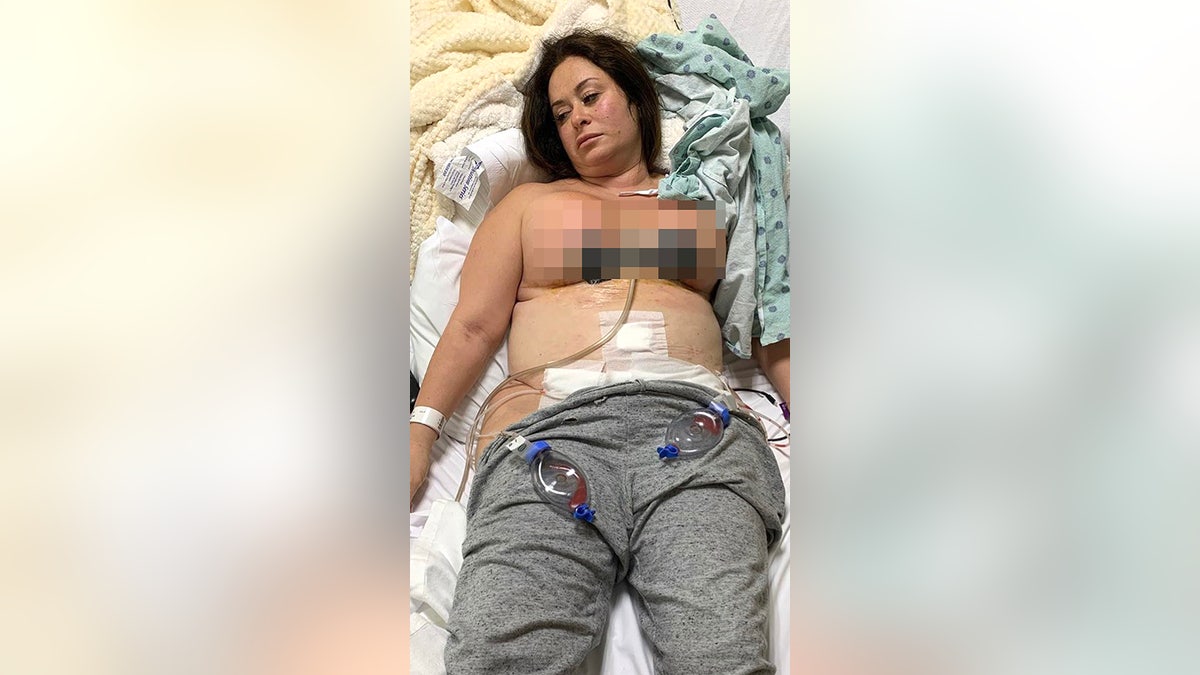 Surgery shock - 'My nipples fell off!' Brave Terri shares her