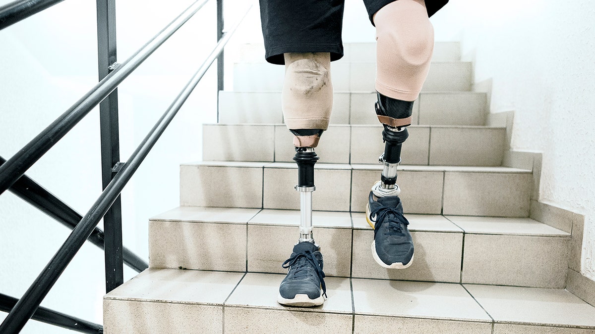 Brett Winters, a senior at Pacific High School in San Bernardino, California, was born without tibia bones in his legs. As a baby, his mother was told by doctors that Winters could either spend life in a wheelchair or amputate his legs.<br data-cke-eol="1">