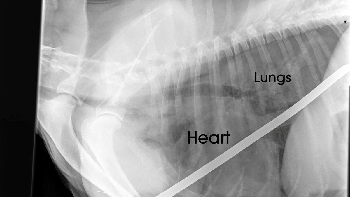 An image of one of Angus' chest X-rays following the "freak accident."