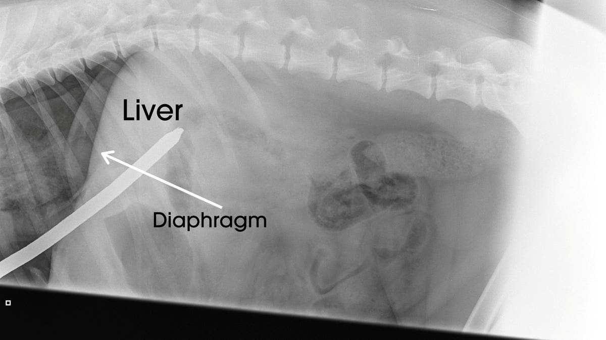 An image of one of Angus' chest X-rays following the "freak accident."