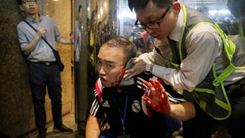 Man subdued after biting off ear of pro-democracy politician, stabbing four in Hong Kong mall