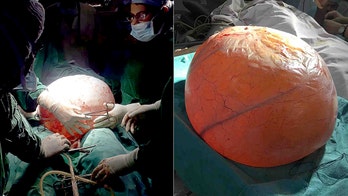 Woman's 40-pound ovarian cyst was impeding her ability to breathe