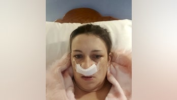 Mom with aggressive cancer will likely lose eyesight, upper teeth during treatment