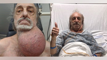New Jersey man has tumor size of his head removed from neck