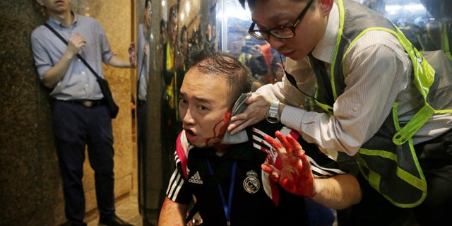 District councilor Andrew Chiu receives medical treatment in Hong Kong, on Sunday, Nov. 3, 2019. Riot police stormed several malls in Hong Kong on Sunday in a move to thwart more pro-democracy protests, though violence did break out when a knife-wielding man slashed several people and bit off part of the ear of a local pro-democracy politician. (Elson Li/HK01 via AP)