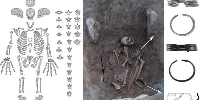 The skeletal remains, which have sustained a number of injuries. Jewelry discovered with the skeleton indicates that the woman was of high status.