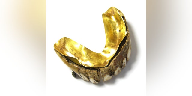 The dentures are made out of gold, and, possibly, hippo ivory. (Hansons Auctioneers and Valuers)
