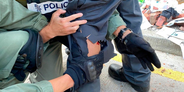 In this photo released by the Hong Kong Police Department, police prepare to remove an arrow from the leg of a fellow officer during a confrontation with protestors at the Hong Kong Polytechnic University in Hong Kong on Sunday.