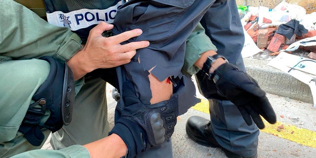 In this photo released by the Hong Kong Police Department, police prepare to remove an arrow from the leg of a fellow officer during a confrontation with protestors at the Hong Kong Polytechnic University in Hong Kong on Sunday.