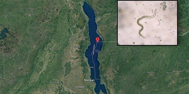 A British man nearly died after a parasite crawled up his penis and started laying eggs after he went for a swim in Lake Malawi in southeast Africa during a "holiday of a lifetime" with pals. (Photo: Google Maps/iStock)