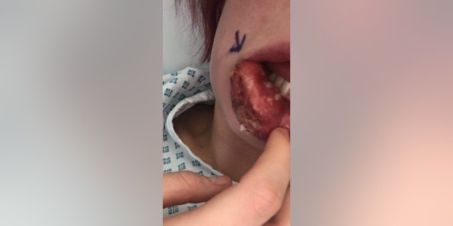 After a week in the hospital, she was finally sent home but said her ordeal is not yet over.