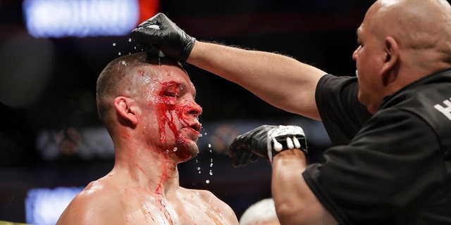 A trainer helps Nate Diaz after the first round of a welterweight mixed martial arts bout against Jorge Masvidal at UFC 244 early Sunday, Nov. 3, 2019, in New York. Masvidal won in the fourth round. (AP Photo/Frank Franklin II)