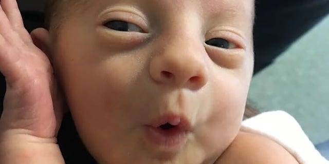 Ahlers said his son was born with two rare birth defects. He was diagnosed with Agenesis of the Corpos Callosum, which affects brain development, and Mosaic Trisomy 9 Syndrome, a rare chromosomal disorder