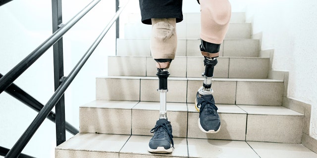 Brett Winters, a senior at Pacific High School in San Bernardino, California, was born without tibia bones in his legs. As a baby, his mother was told by doctors that Winters could either spend life in a wheelchair or amputate his legs.<br data-cke-eol="1">