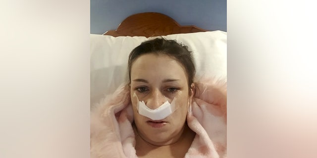 Kerry Borlase a few hours after biopsy.