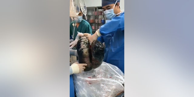 The transplant team ultimately rejected the organs because of the extensive damage.
