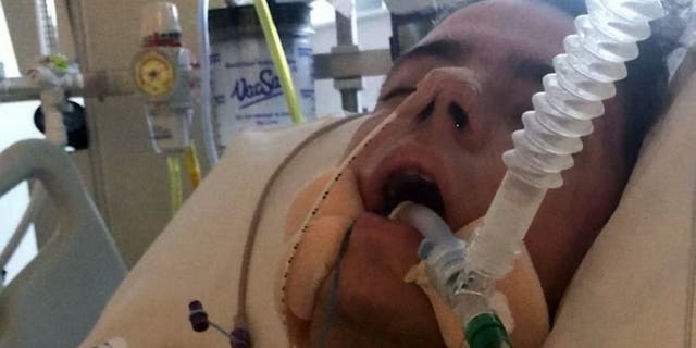 Griffin, who missed his 21st birthday while in a coma, said his symptoms started with vomiting before progressing to a severe headache and stiffness in his neck.