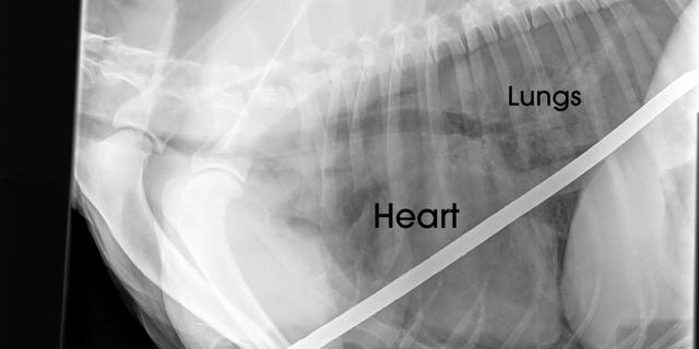 An image of one of Angus' chest X-rays following the "freak accident."