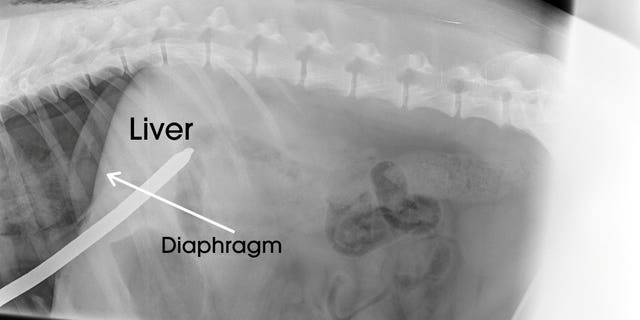An image of one of Angus' chest X-rays following the "freak accident."