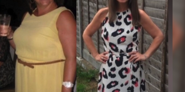 The 43-year-old mom claims the cyst caused her to lose 70 pounds because she was unable to eat properly.