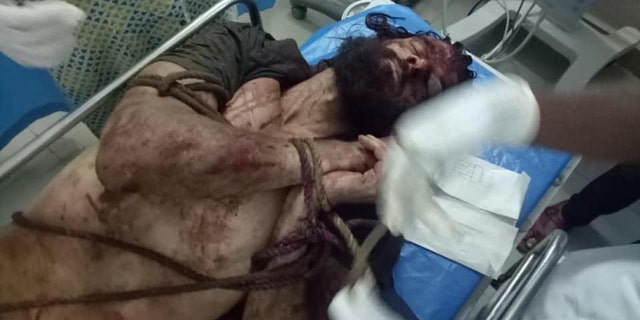 James was pictured lying in a hospital bed with a rope still tied around his wrists. His body was covered in dirt, blood and bruises.