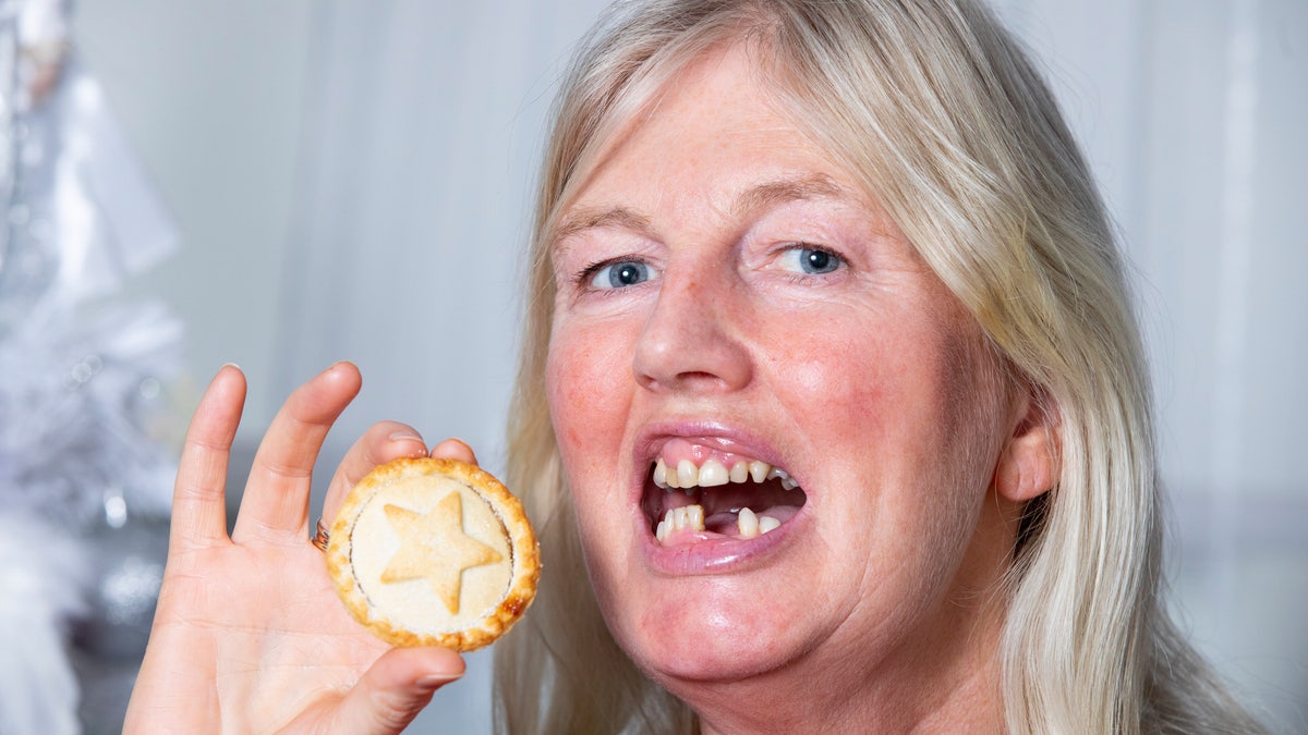Angela McGill lost two of her front teeth when eating a mince pie. 