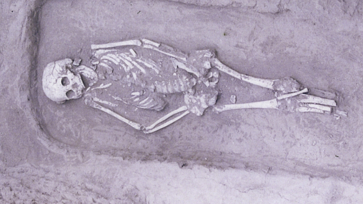 A skeleton found in China belonged to an individual with a rare form of dwarfism. (Credit: Halcrow et al. 2019)