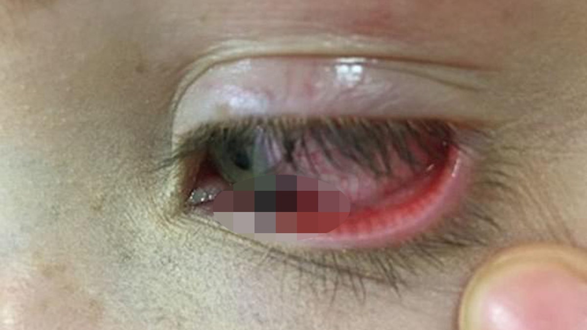 The lead in the girl's eye.