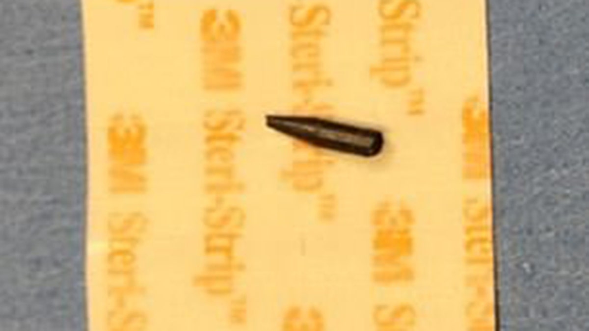 A piece of lead removed from the girl's eye.