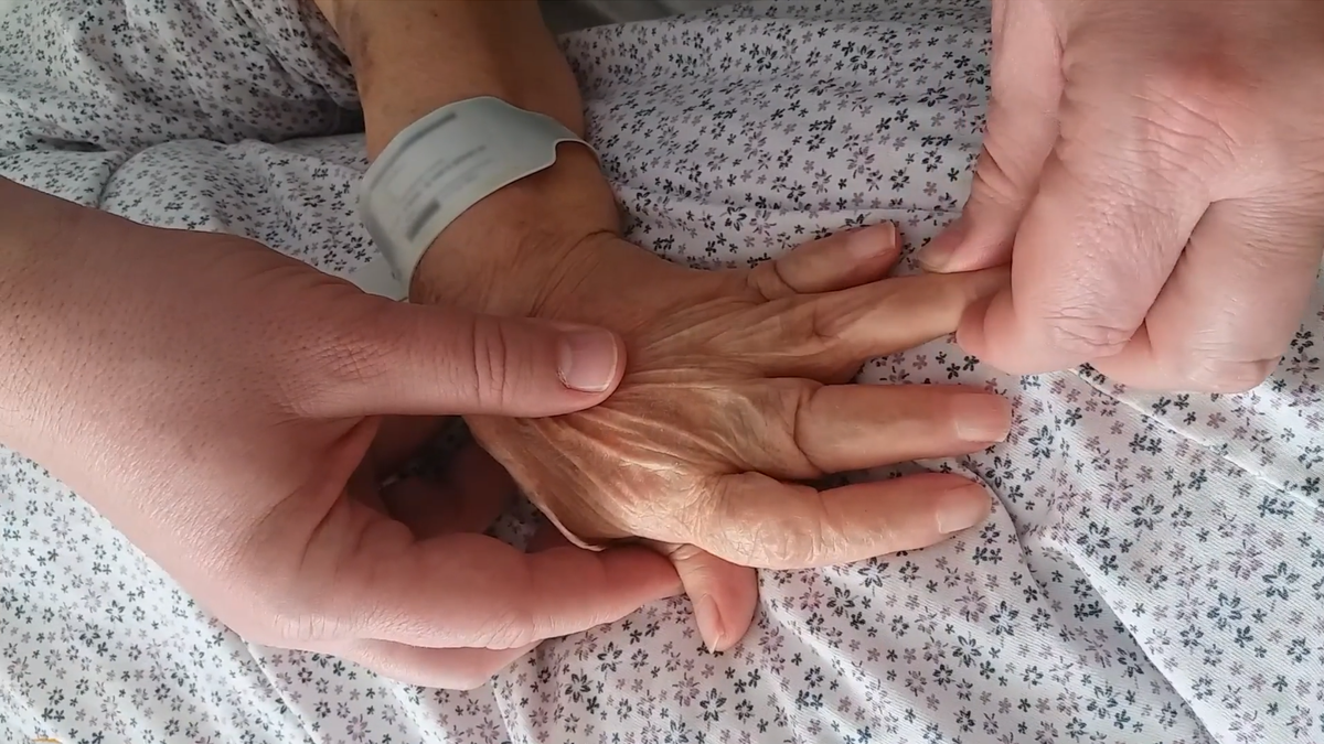 A doctor treating the woman gently pulled her finger tips to temporarily straighten her fingers.