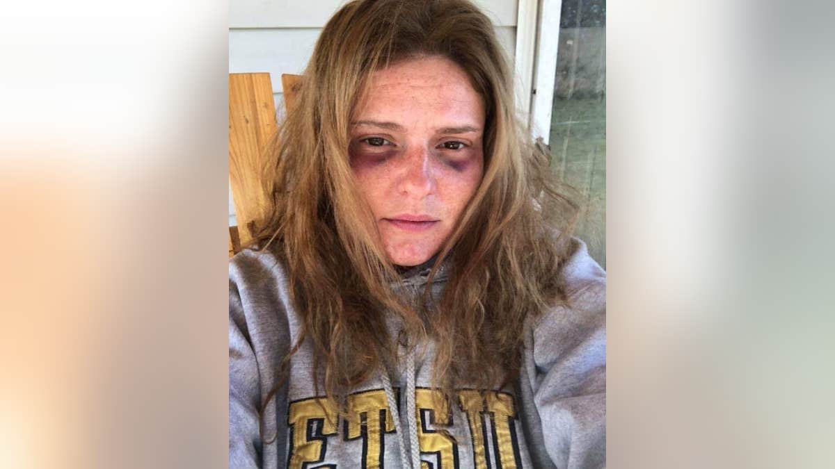 Facebook messages showed that Haley had reached out to a fellow member of a domestic-violence support group and declared that she had been “beaten pretty bad” by her estranged husband a week earlier.