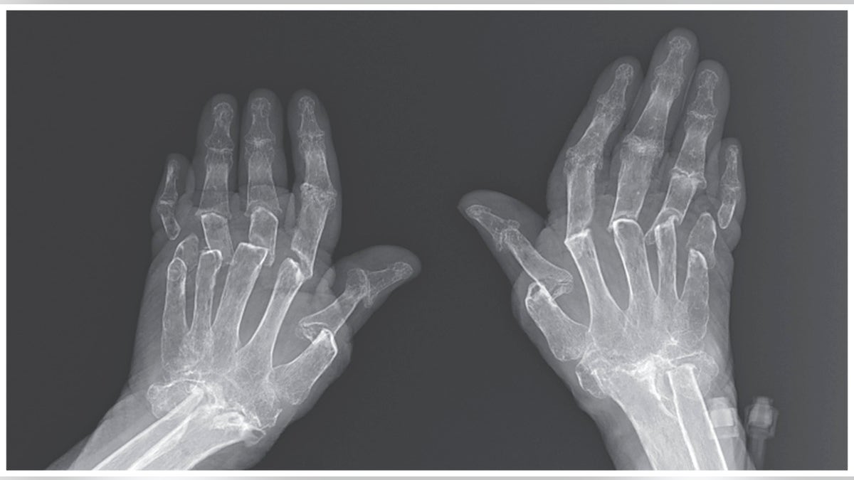 An X-ray of the woman's hands.