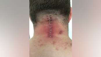 Supermarket fridge door unhinges, lands on man's neck 'like a guillotine' in freak accident