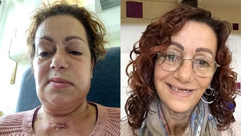 Woman's jaw reconstructed using part of shoulder following cancer diagnosis