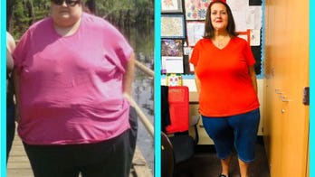 California woman loses 350 pounds after gastric surgery, says she once ate 10,000 calories a day