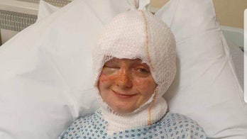 Woman suffers severe burns after hair catches fire as she was blowing out a candle