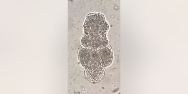 Humans who consume undercooked or raw beef or pork are at risk of contracting the parasite.