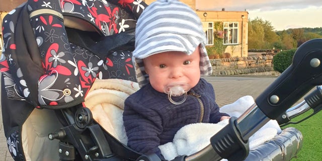 Michal Winter was born with harlequin ichthyosis, a rare condition that causes his skin to shed every day and become red, cracked and dry and puts him at severe risk of infections.