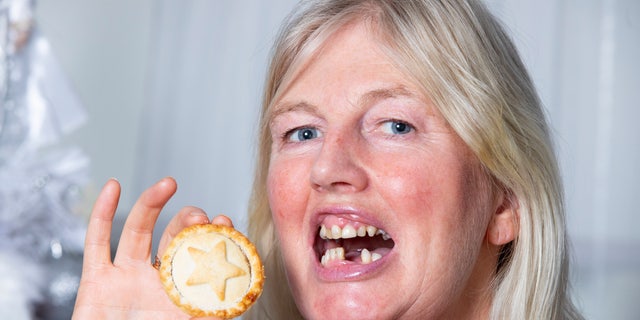 Angela McGill lost two of her front teeth when eating a mince pie. 