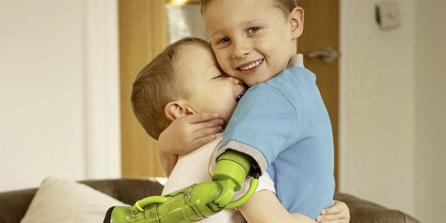Jacob Scrimshaw, 5, hugging his younger brother Sebastian, 3 with his new prosthetic arm.