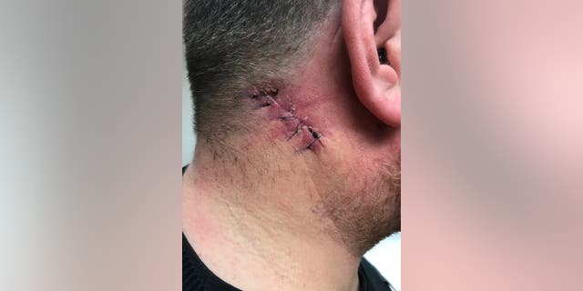 Another photo of Stuart Clegg post-op.